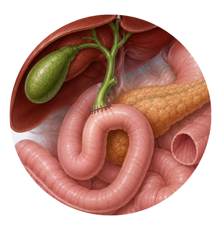 Biliary Reconstruction and Repair